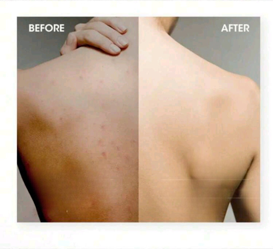 ScrubMe Silicone Body Exfoliator
